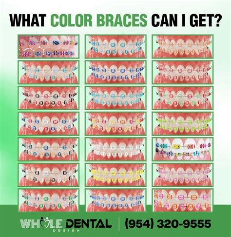 Braces Colors Avon Dental Round Lake Beach Illinois Braces Colors Avon Dental Round Lake Beach Illinois
