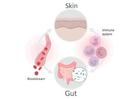 Dermatologist Inflammation Skin Gut Health