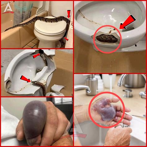 Ht10 In Several Regions While Using Their Toilets People Were