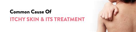 Itchy Skin Causes And Treatments Explained