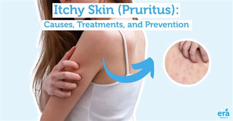 Itchy Skin Pruritus Causes Treatments And Prenvetion Era Organics
