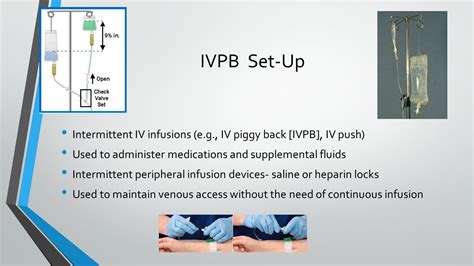 Unlock the Power of IVPB in Medical Care