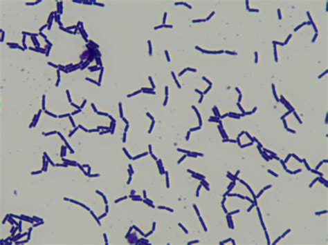 Lacticaseibacillus Casei Cect 9104 Health Benefits