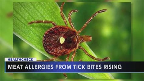 Lone Star Tick Bite Could Lead To Red Meat Allergy Cbs Boston