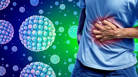 Norovirus Cases Rise In 2025 What Is It Symptoms How Long It Lasts