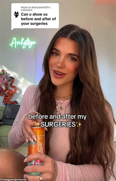 Onlyfans Model Ari Kytsya Reveals Her True Feelings About Celebrity Plastic Surgery Daily Mail Online