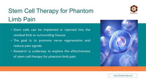 Phantom Limb Pain Exploring Stem Cell Solutions Dr David Greene Pptx