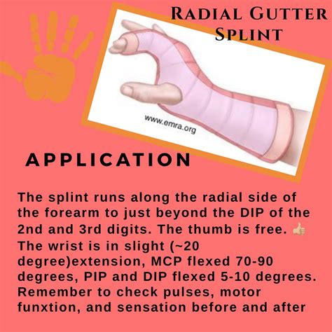 Expert Guide to Radial Gutter Splints