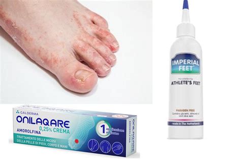 Roycederm Tratamiento De Ti A Versicolor Tratamiento De Pie De Atleta