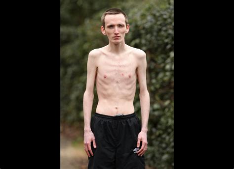 Skinniest Man In World