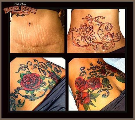 Stomach Tattoos To Cover Tummy Tuck Scar Stomach Tattoos To Cover Tummy Tuck Scar