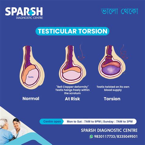 Testicular Torsion
