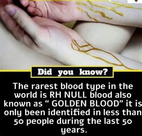 This Man Has The Rarest Blood Type In The World Known As Rh Null It S Known As The Golden Blood Type Because Of Its Rarity Being Found In Only 43 People Throughout All