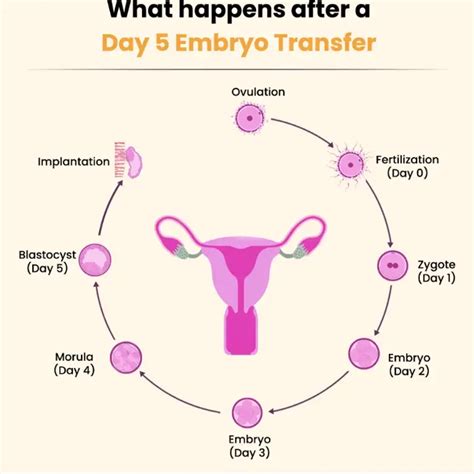 What Day Of The Cycle Does Embryo Transfer