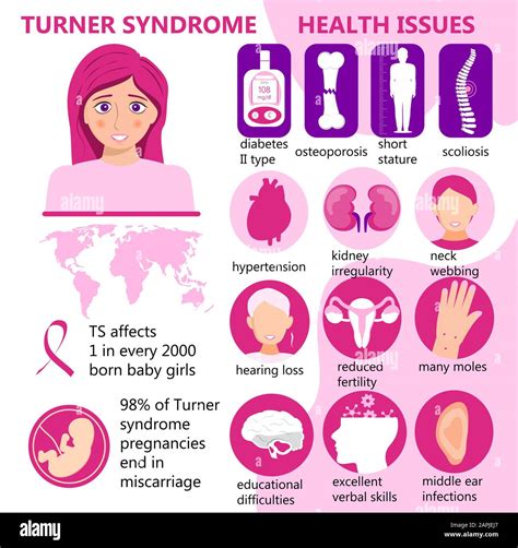 What Is Turner Syndrome Healthsketch