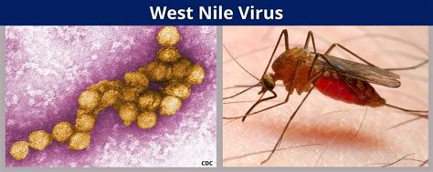 What To Know About West Nile Virus The Illness That Sickened Dr